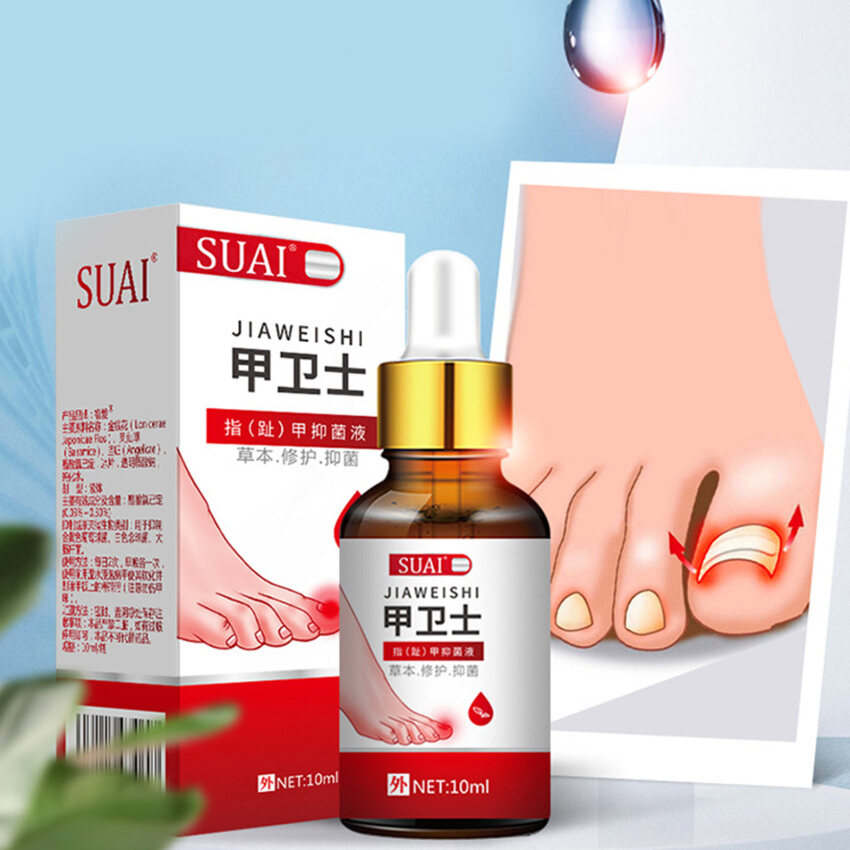 Nail Fungal Treatment Feet Care Essence Nail Foot Whitening Toe Nail Fungus Removal Gel Anti Infection Paronychia Onychomycosis